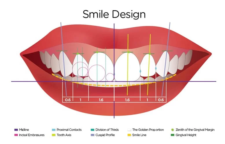 Smile Design Cost in Istanbul 2024 | Start 2,990 TL Call Now